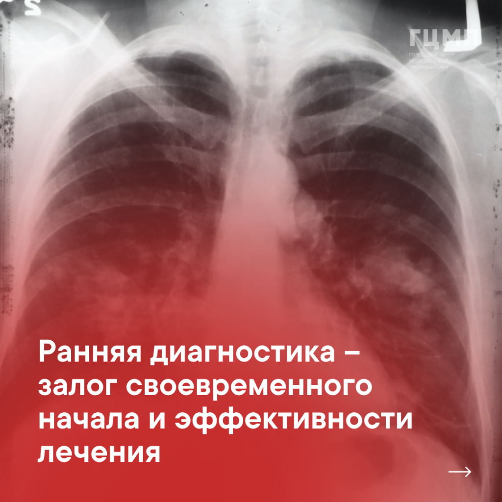 rak-lungs-1.png